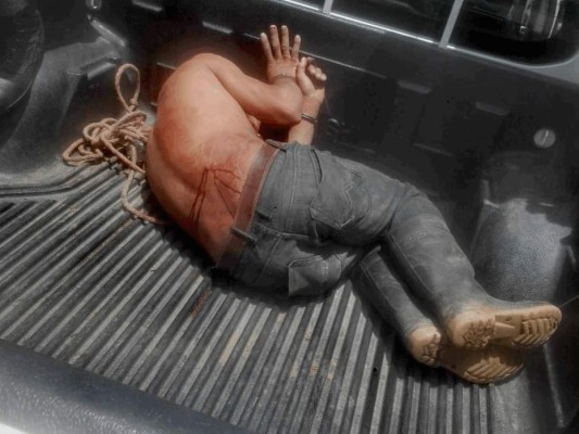 Hombre sale herido tras enfrentarse a la policía en Guaymaca