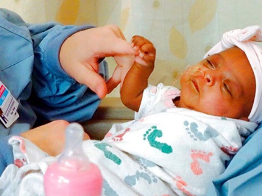 Sobrevive bebé prematura de apenas media libra de peso