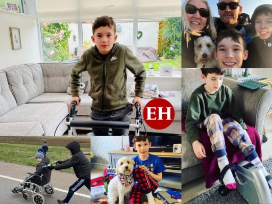 La dramática historia de Jacob, un niño de 10 años que dejó de caminar a causa del coronavirus (FOTOS)