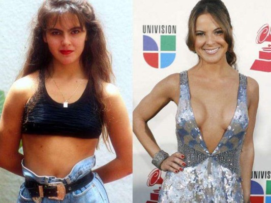 Antes y después: así lucen varias famosas mexicanas después de las cirugías