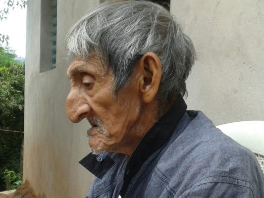 Muere en el Hospital Escuela el cacique tolupán Cipriano Martínez