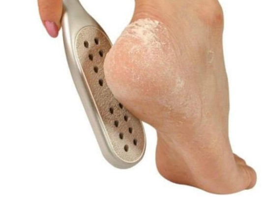 Despídete de los callos y durezas en los pies con un potente remedio casero