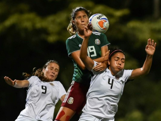 Mujeres son más propensas a daño cerebral por cabecear balones
