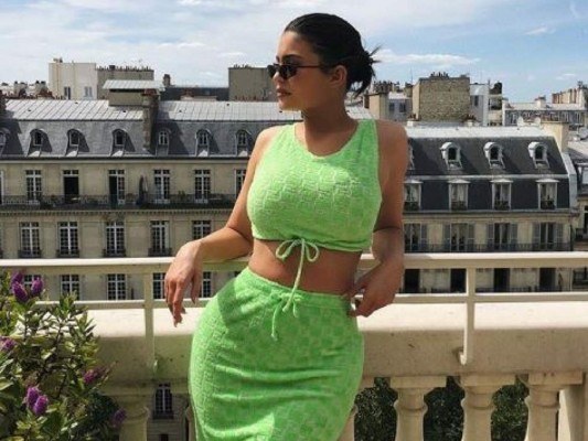 Así luce Kylie Jenner después de quitarse el relleno de los labios&nbsp;&nbsp;