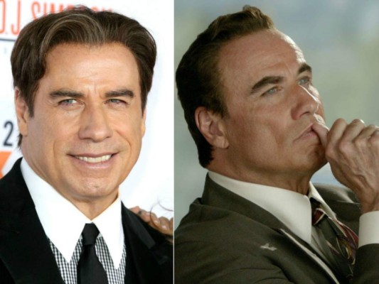 Cirujanos plásticos que hicieron desastres con los famosos