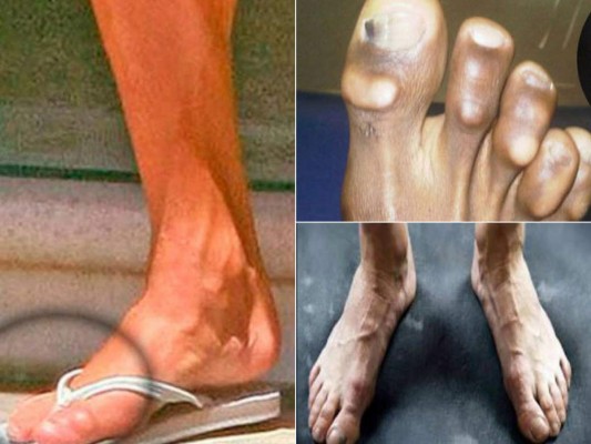 FOTOS: Los mejores futbolistas del mundo tienen los pies más feos