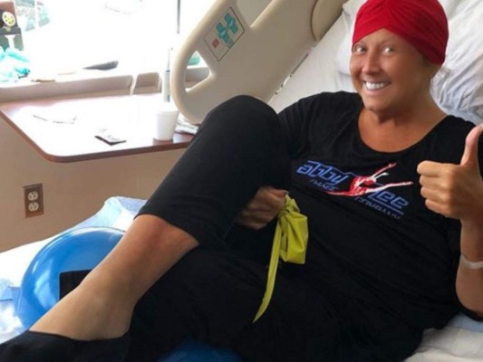 FOTOS: Los cambios físicos que sufrió Abby Lee Miller de 'Dance Moms' por su lucha contra el cáncer  