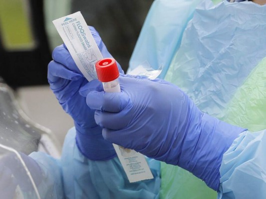 Honduras compra 250 mil pruebas PCR para detectar coronavirus