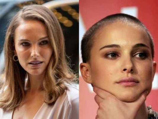 Antes y después: Famosas que se raparon el pelo y lucieron hermosas