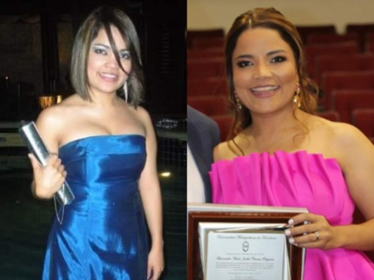 FOTOS: Así lucen estas conocidas hondureñas tras someterse a cirugías