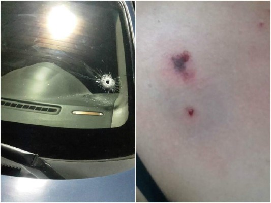 Secretaría de Seguridad investiga supuesto atentado contra periodista Jhony Lagos