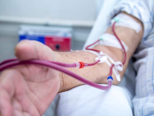 ¿Pacientes renales tienen mayor riesgo de morir por covid-19?&nbsp;&nbsp;