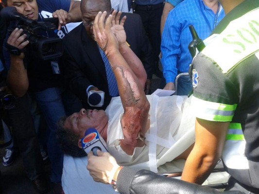 Honduras: Infierno desata explosión en Feria del Agricultor y el Artesano