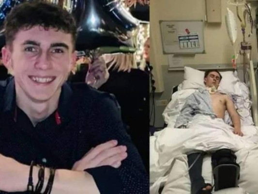 El caso de Joseph Flavill, el joven que estuvo en coma y se infectó de covid-19&nbsp;&nbsp;