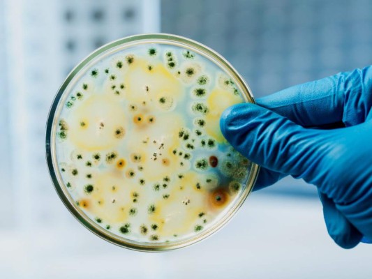 ¿Qué es el cólera y cómo debemos cuidarnos los hondureños?