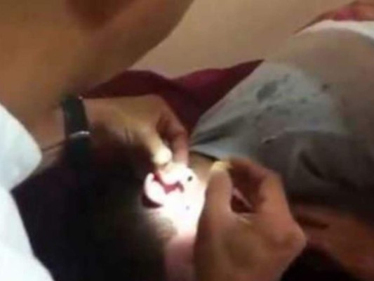 El Salvador: Conmoción por la muerte de niño tras extracción de un frijol en el oído