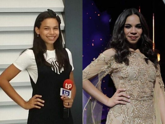 FOTOS: El cambio físico de Angie Flores antes y después de llegar a La Academia