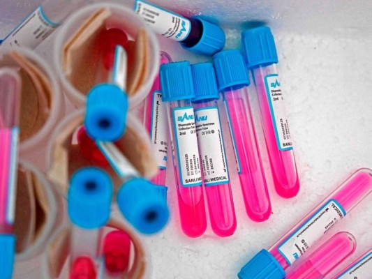 Países con menos contagios de covid-19 realizan más pruebas que Honduras