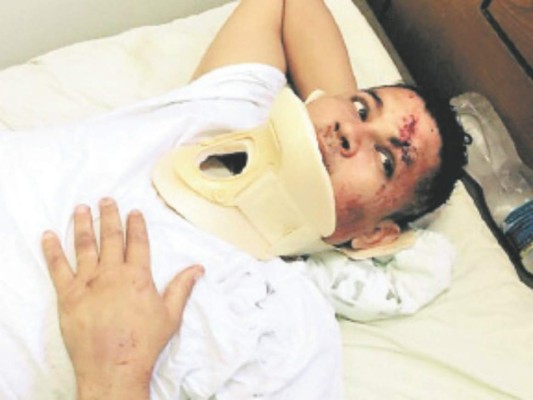 Sobreviviente de accidente frente a BCH: 'Me siento mal, pero gracias a Dios estoy con vida después de ese encontronazo”