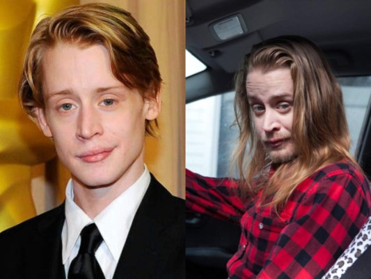 El antes y después de los famosos tras dejar las drogas