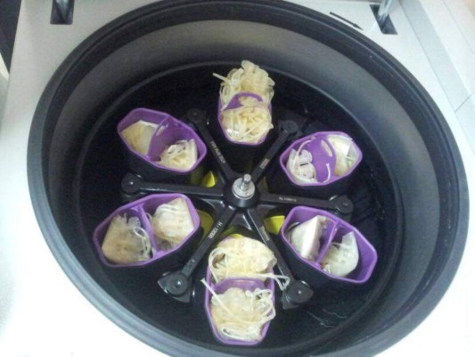 El HEU triplica capacidad de separación de componentes de la sangre&nbsp;&nbsp;