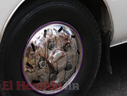 FOTOS: Terrible acto criminal contra conductor de rapidito en el bulevar FF AA de la capital