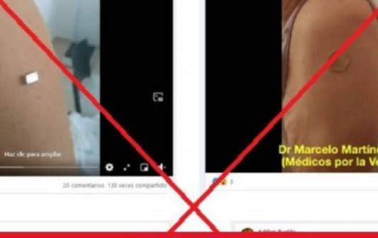 ¿Las vacunas contra el covid-19 generan atracción magnética?