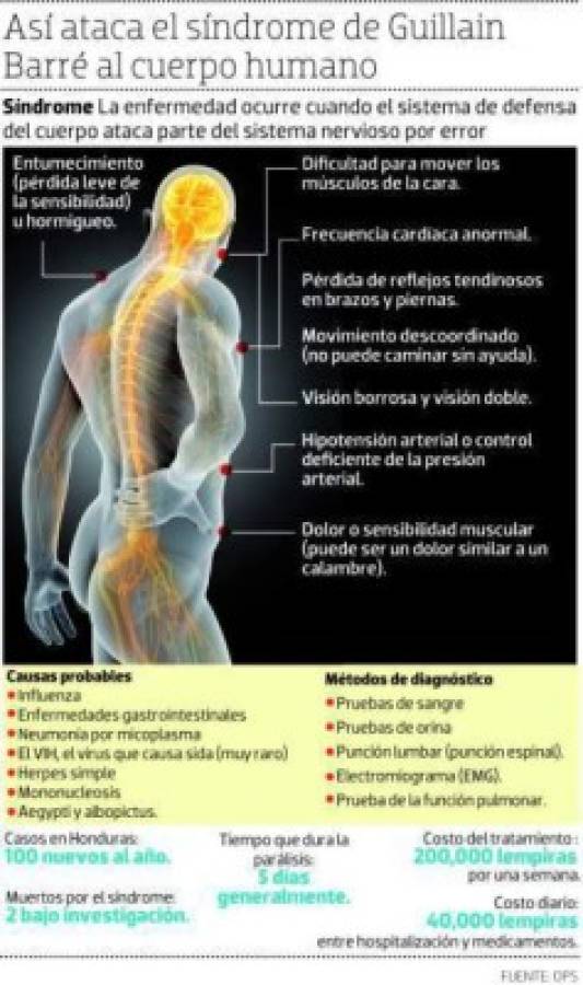 Afectación del Síndrome de Guillain Barré en los seres humanos, infografía: El Heraldo.