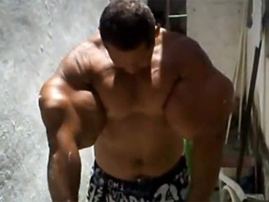 VIDEO: Desarrolló súper músculos con inyecciones de aceite y alcohol