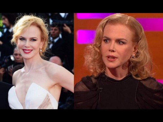 El cambio de rostro de Nicole Kidman