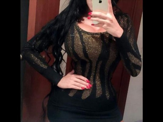 Así luce la mujer que por siete años usó 'corset”