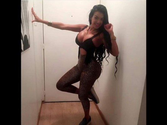 Así luce la mujer que por siete años usó 'corset”