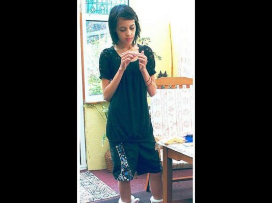 Jovencita venció la anorexia y ahora luce increíble