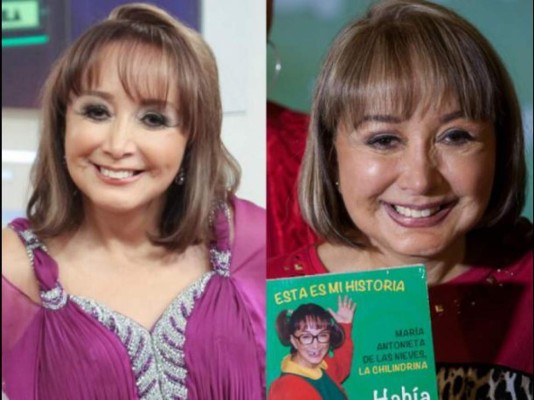 ¿Qué le pasó a la Chilindrina en el rostro?