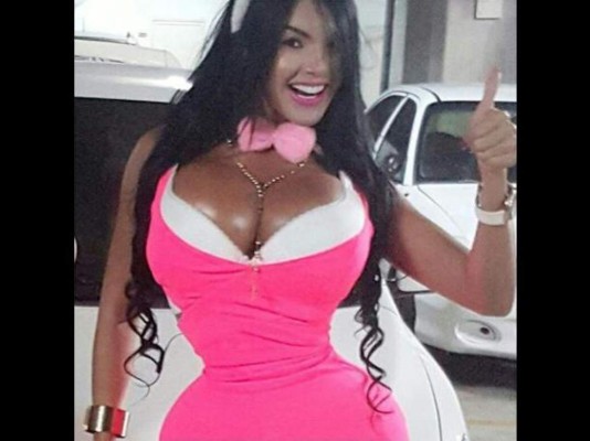 Así luce la mujer que por siete años usó 'corset”