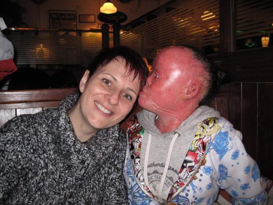 Escondió su rostro por 22 años