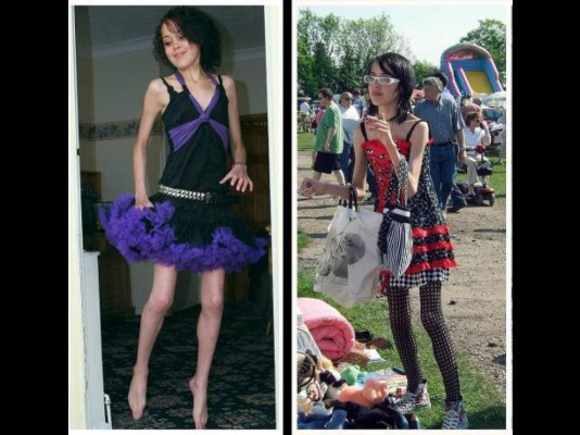 Jovencita venció la anorexia y ahora luce increíble