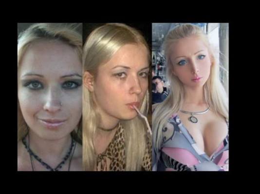 Así lucía la ''Barbie humana'' antes de las cirugías