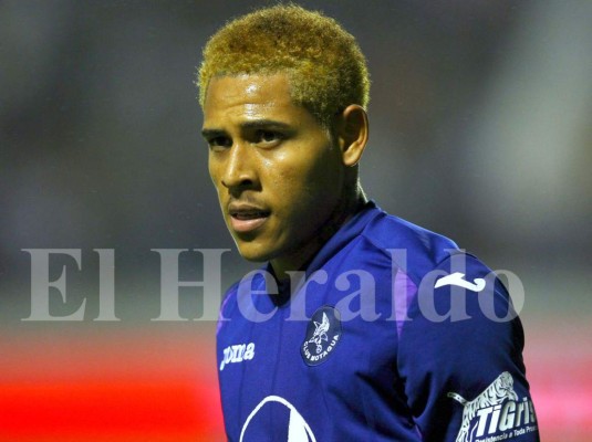 GALERIA: Henry Figueroa, el señor de los peinados ahora luce el estilo Bob Patiño