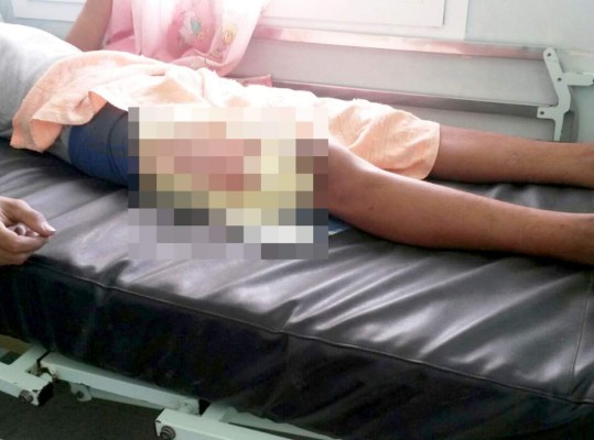 Honduras: Reportan 19 quemados con pólvora