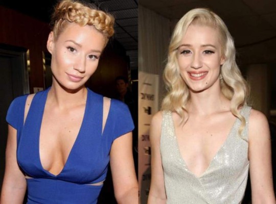 ¿Adicta a las cirugías plásticas? Iggy Azalea reaparece con nuevo rostro