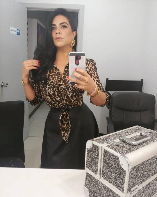 Ella es Ana Laura Mejía, la presentadora hondureña que fue atacada por un pitbull