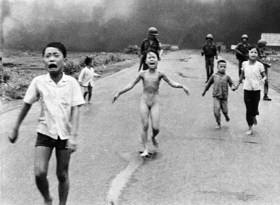 'La niña del napalm' se atiende cicatrices con láser