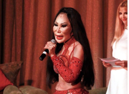 Las celebridades latinas que casi mueren por una mala cirugía estética