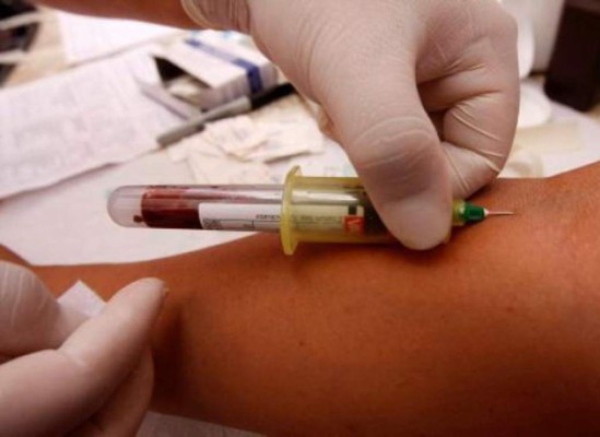 HEU comprará lote de reactivos