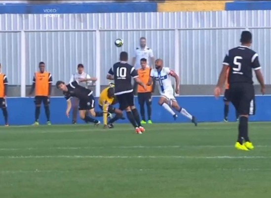 Árbitro sufre fuerte fractura en su pie cuando dirigía un partido en la serie B de Brasil