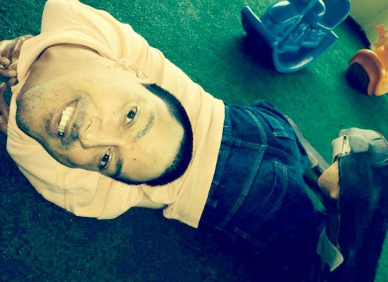 Impresionante: Hombre vive con la cabeza al revés