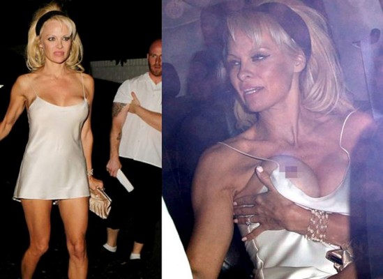 Pamela Anderson sufre incidente y muestra su seno