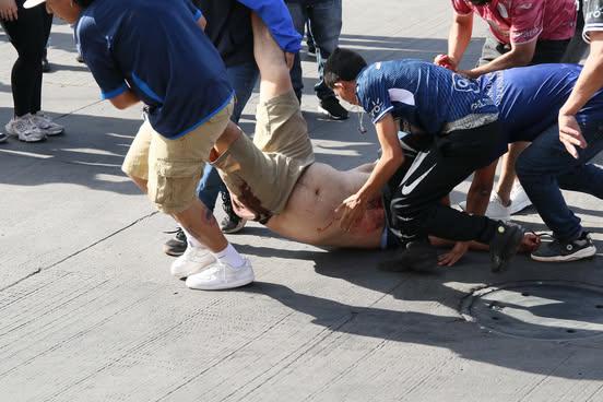 En fotos: Heridos, disparos y un caos total en las afueras del Nacional previo al Motagua vs Olimpia