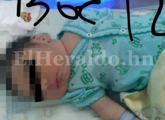 Honduras: Salud declara emergencia por casos de microcefalia en Choluteca